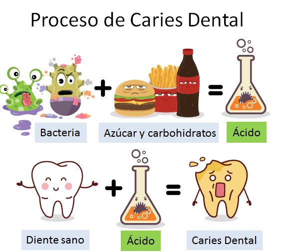 Proceso de caries dental